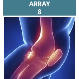 Array 8 – Joint Autoimmune Reactivity Screen